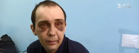 Відкрита ЧМТ і важкий перелом щелепи: на Київщині водій маршрутки жорстоко побив пасажира за 2 гривні