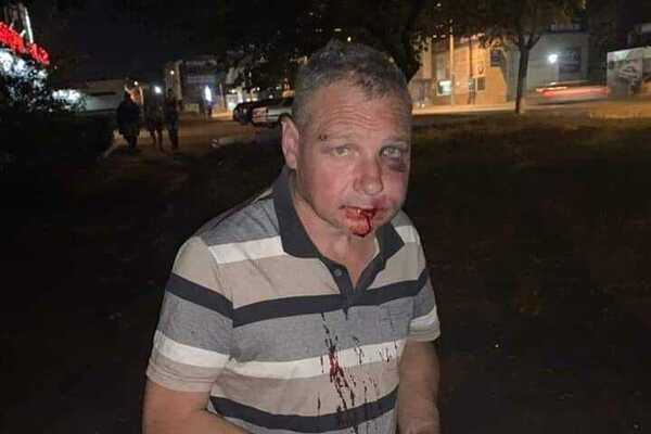 Різав собаку перед дітьми: у Дніпрі шкуродер розплатився життям за жорстокість(ФОТО)