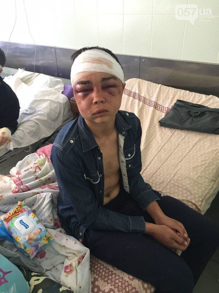Катували і гвалтували: двоє чоловіків жорстоко познущалися з 17-річного хлопця (ФОТО 18+)