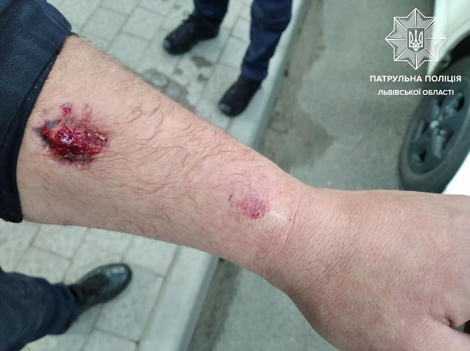 У Львові п’яний водій покусав до крові поліцейського: шокуючі подробиці (ФОТО)